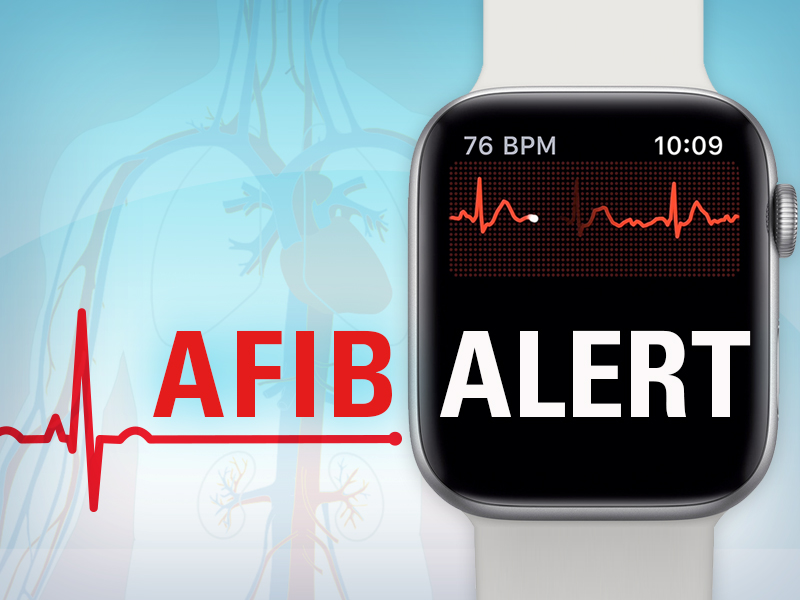 Latest-gen smartwatch app can help detect irregular heartbeat